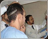 Foto Área doadora Fios longos