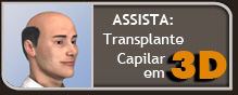 Logo - 4º Congresso Brasileiro de Restauração Capilar