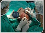 Photo of Hair Implant Surgery