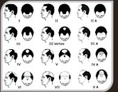 Image classification Norwood Image classification Norwood