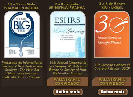 Procedimento Realizados: Megasessão, Gigasessão, Dense-packing, Preview Long Hair, Cirurgias Reparadoras e FUE